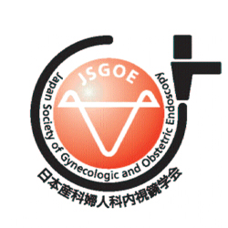 jsgoe
